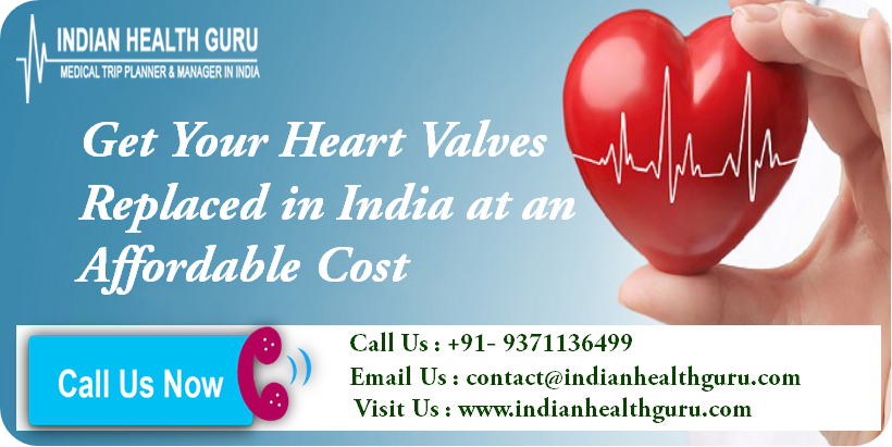 Get Your Heart Valves Replaced in India at an Affordable Cost
