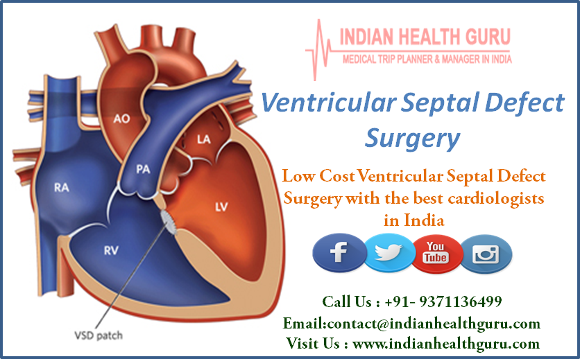 Low Cost Ventricular Septal Defect Surgery with the best cardiologists in India